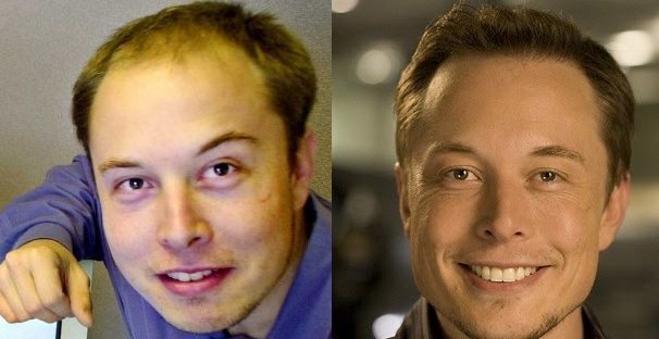 Goal: Become so rich that your hairline comes back
