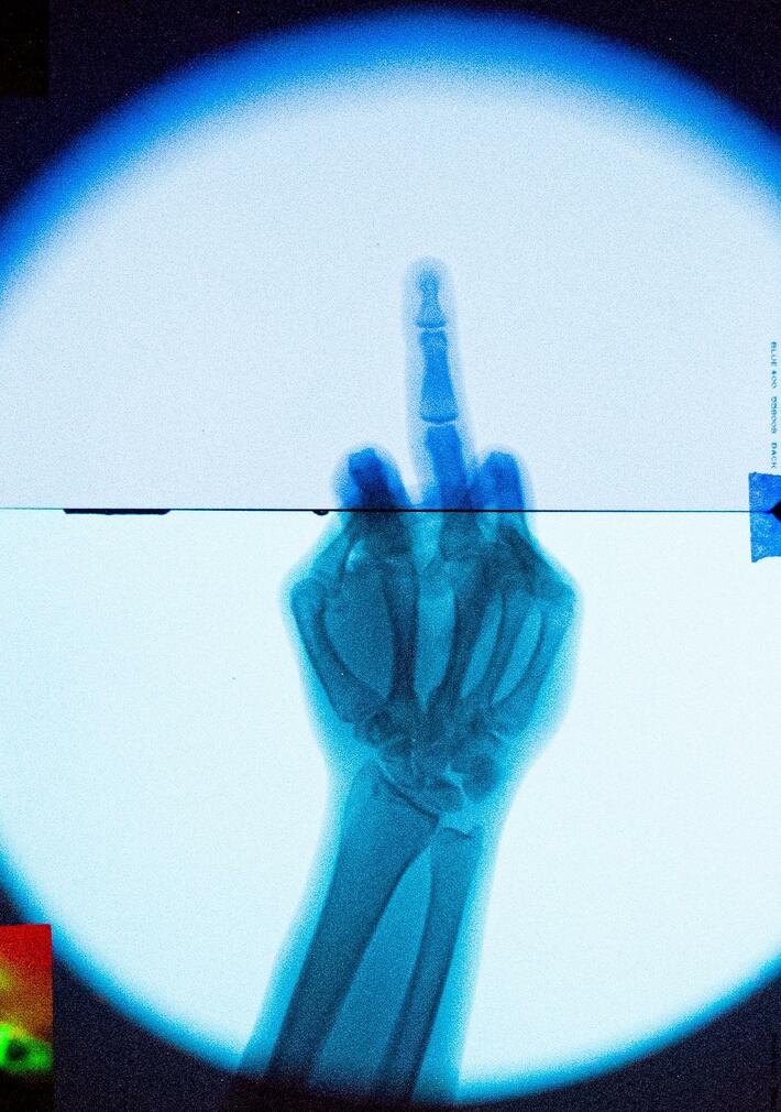 to all the haters who said i shouldn't build an x-ray machine in my garage