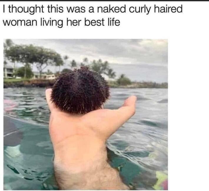 It’s a sea urchin…