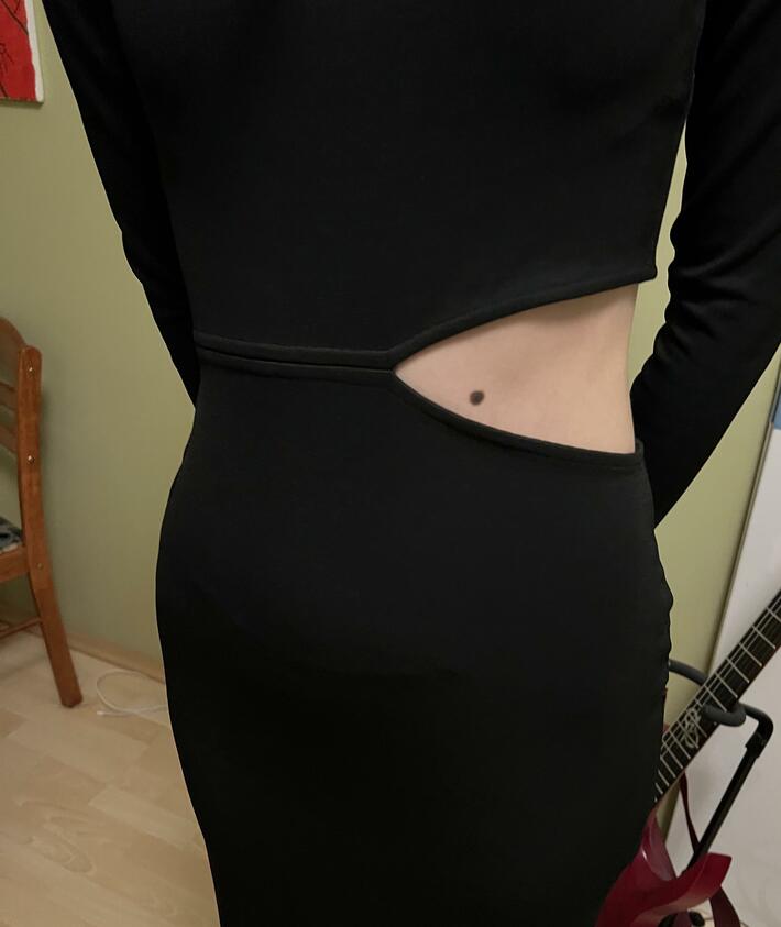 My gf new dress, birthmark makes it looks like a shark