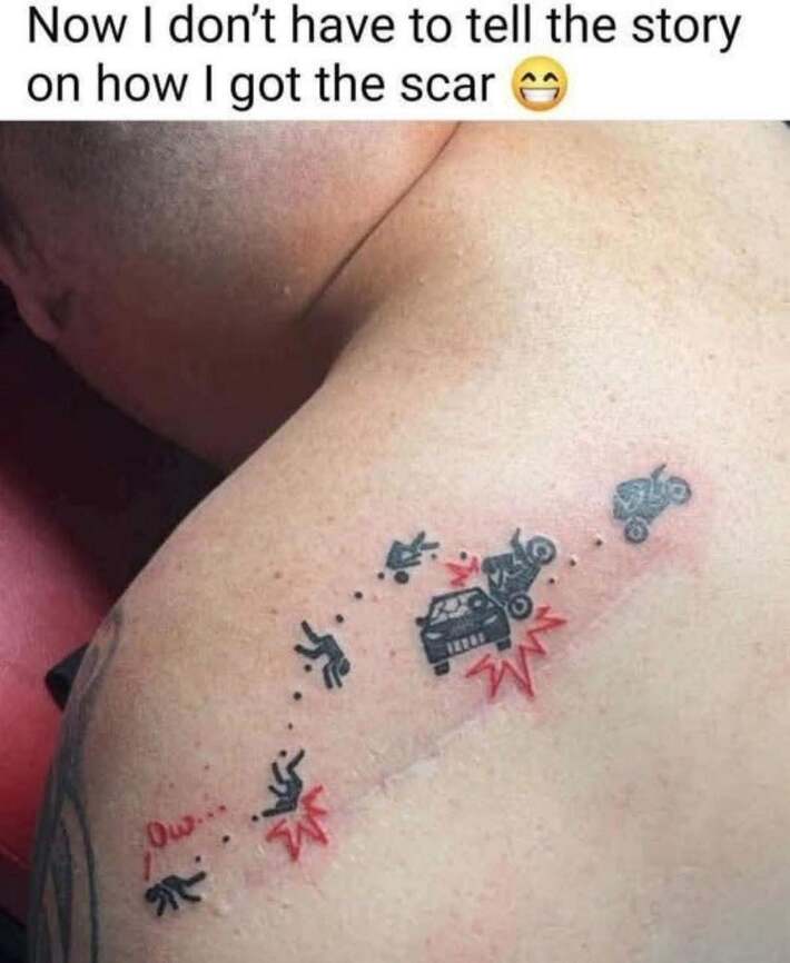 Wanna know how I got these scars?